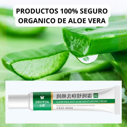 CREMA ANTIACNE DE ALOE VERA 100% EFECTIVO